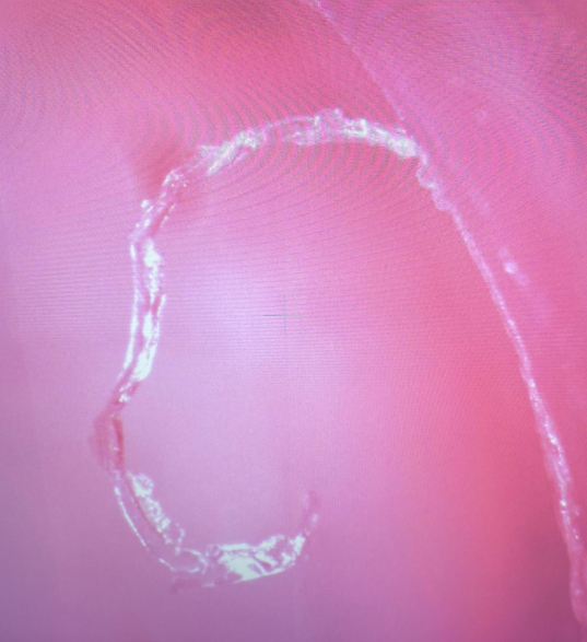 Particulate on vial or line context